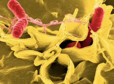 14 people sick in salmonella outbreak linked to Clairemont cafe