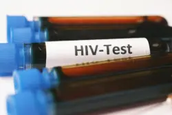 CDC cancels grant that funded free home test kits for HIV