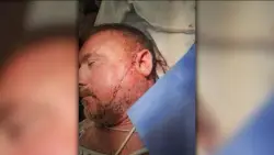 Man gets over 50 stitches after being slashed by stranger outside Tufts Medical Center